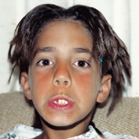 Dreadlocks